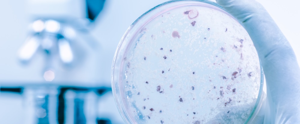 rischi-legionella